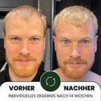 Lumixos™ System für dichter wirkendes Haar