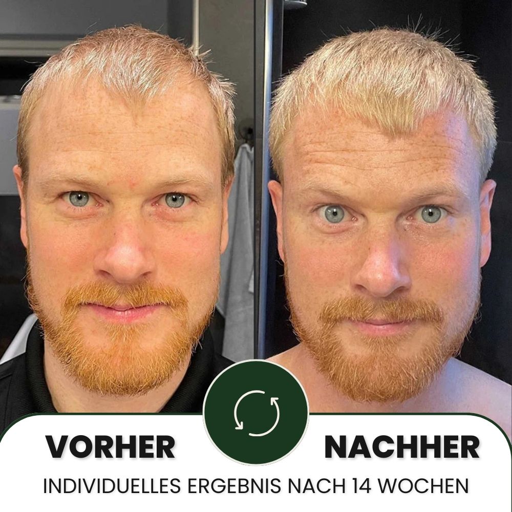 Lumixos™ System für dichter wirkendes Haar