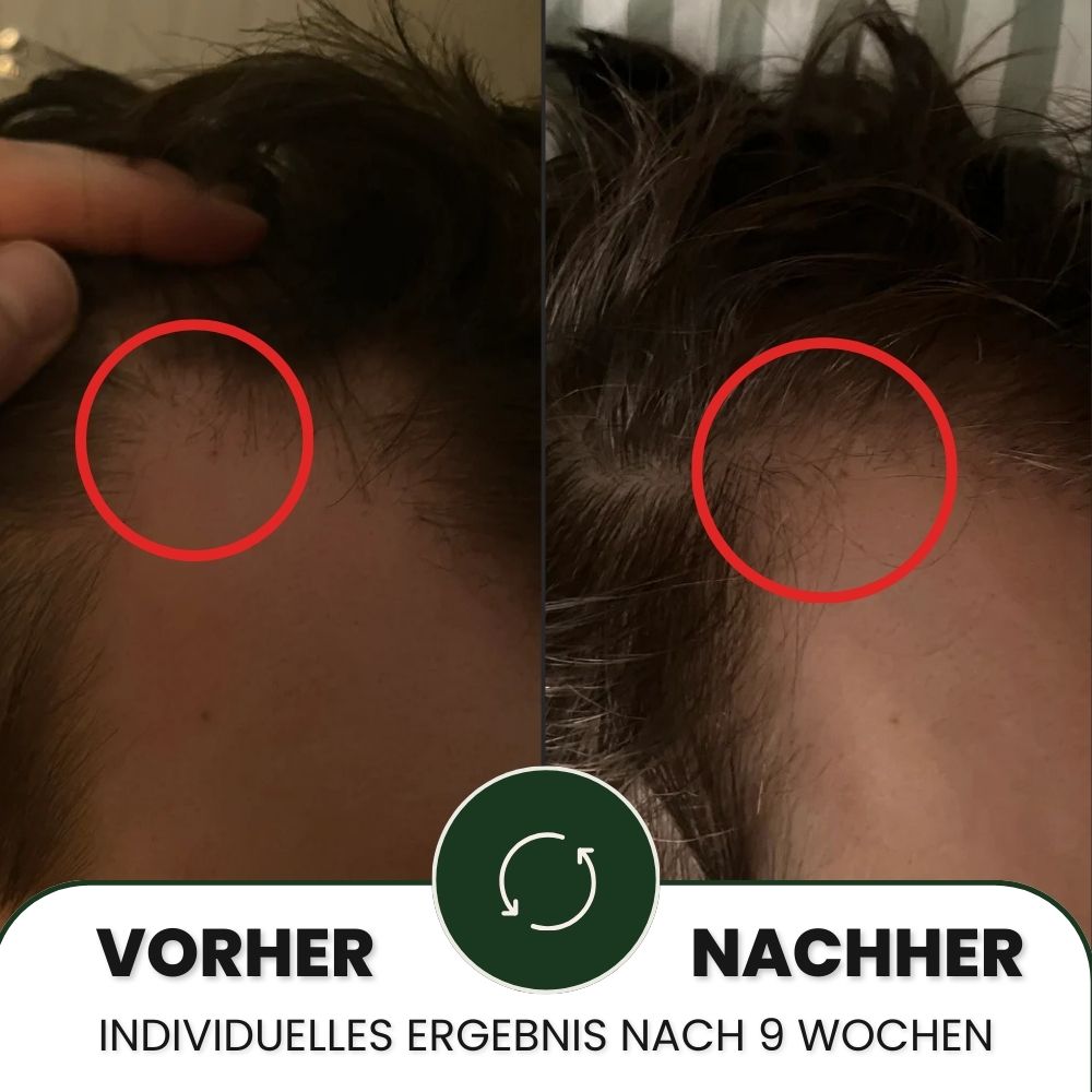 Lumixos™ System für dichter wirkendes Haar