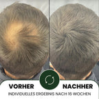 Lumixos™ System für dichter wirkendes Haar