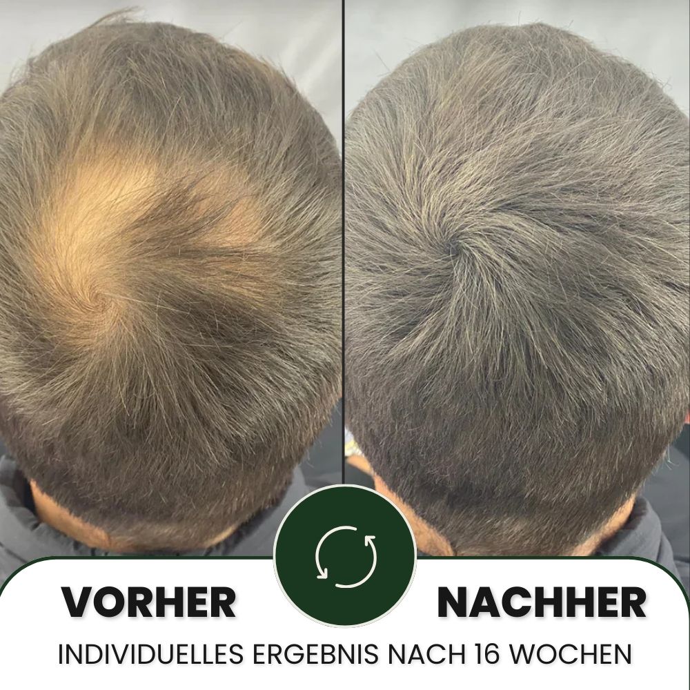 Lumixos™ System für dichter wirkendes Haar