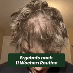 Lumixos™ System für dichter wirkendes Haar